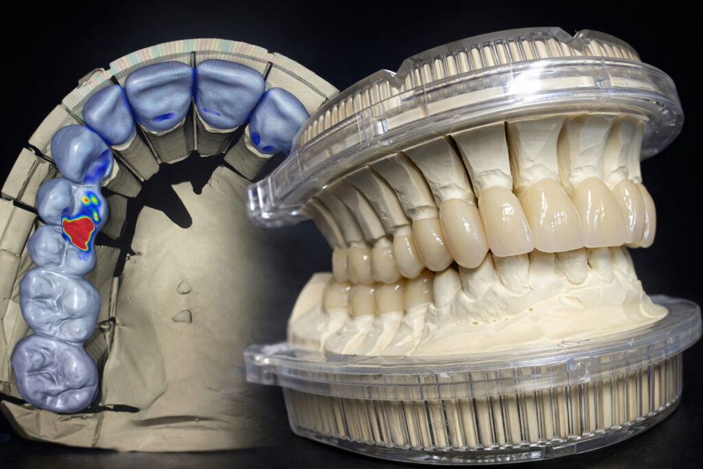 Bild Ästhetische Zahnmedizin Zahnersatz Veneers Zahnarzt Berlin Lichtenberg