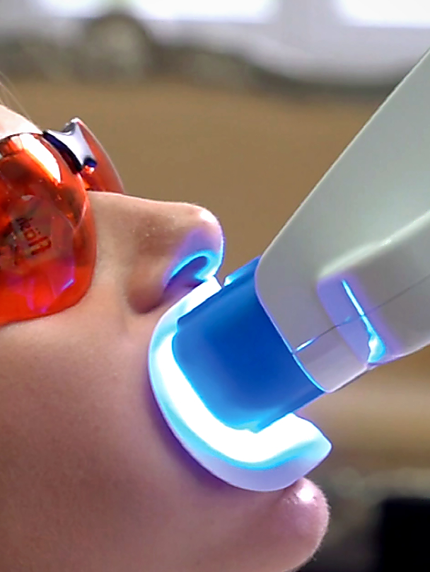 bleaching behandlung zahnarzt berlin lichtenberg | Zahnarztpraxis Dr. Anne Kehler in Lichtenberg